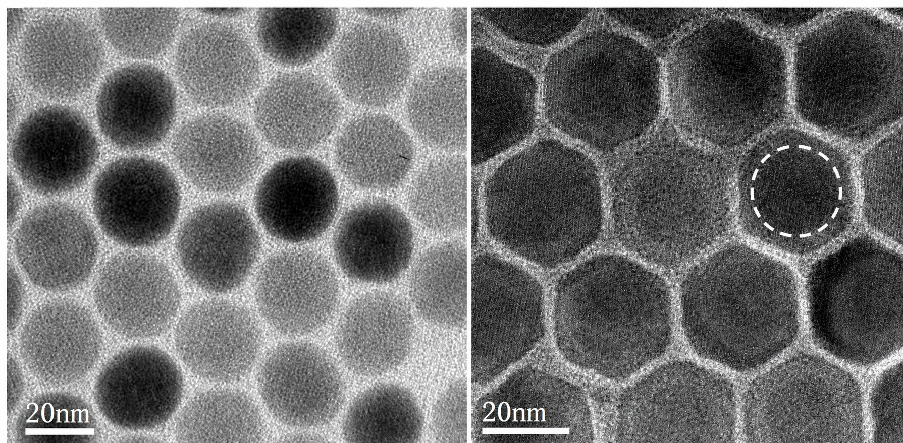 TEM micrograph of monodisperse NaYF₄:Yb,Er upconversion nanoparticles