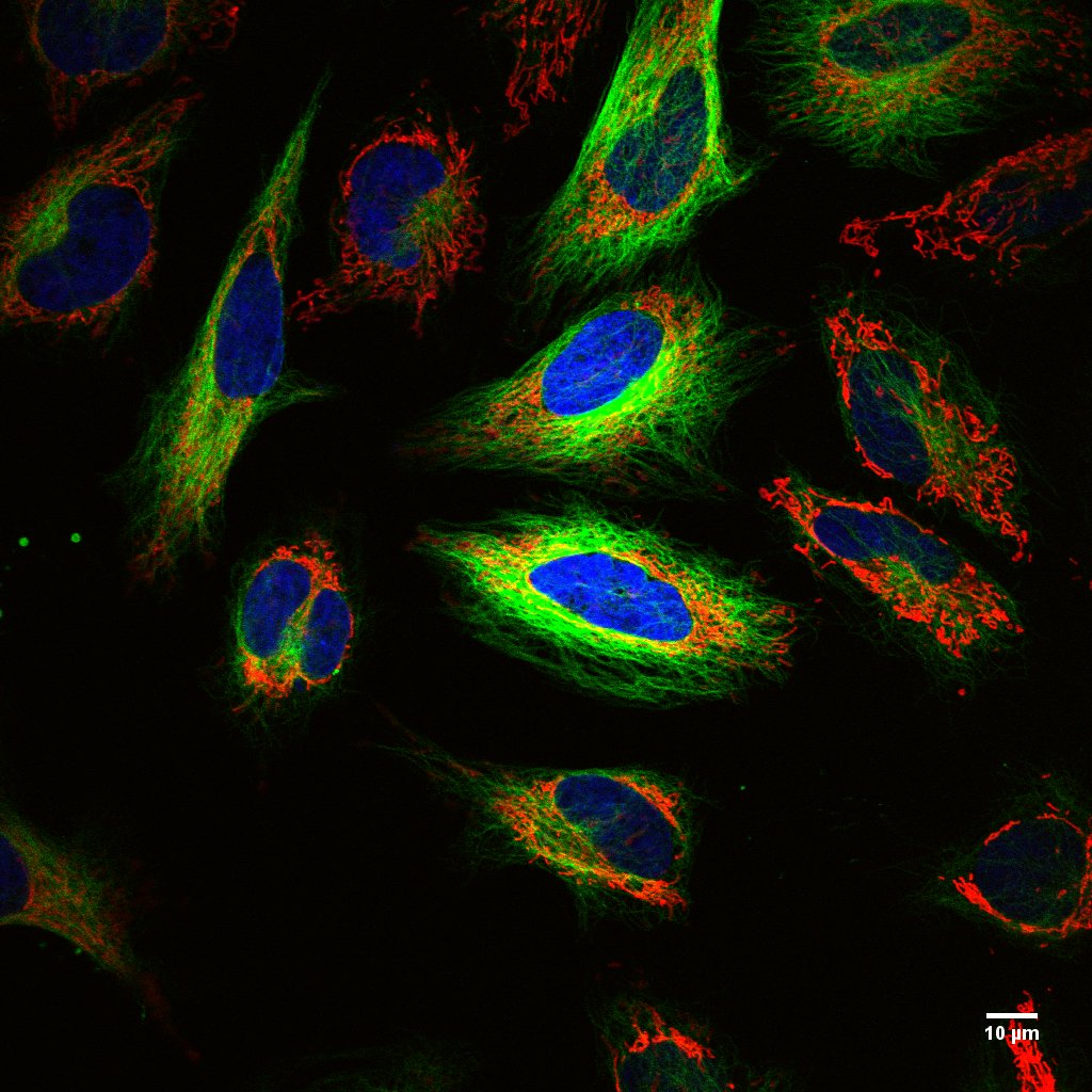 Multiplexed Immunofluorescence Imaging